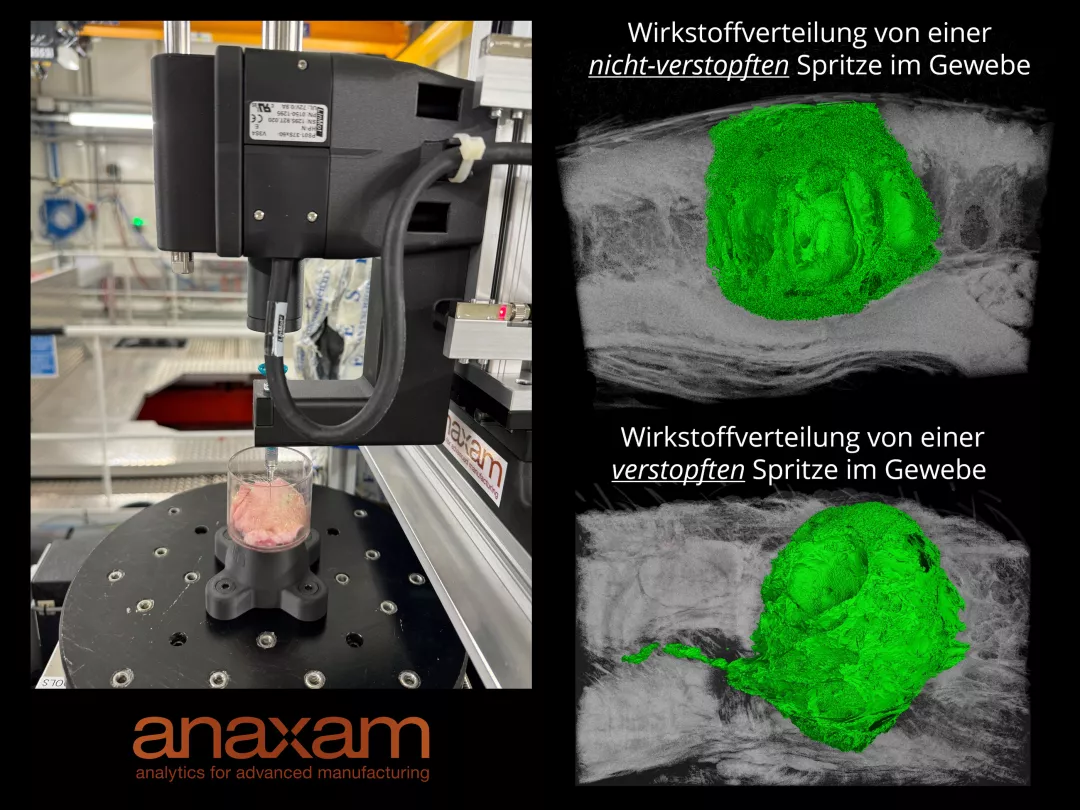 NOVARTIS - non-clogged syringe (de)