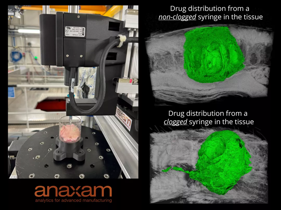 NOVARTIS - non-clogged syringe (en)